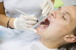Bayerns Zahnärzte sind führend bei der Parodontitis-Erkennung