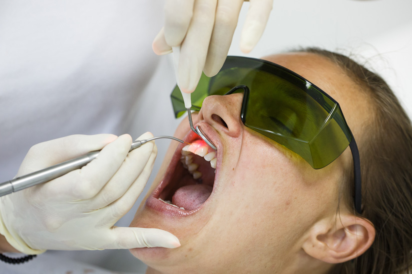 Parodontitis: Zahnärzte fordern strukturierte Nachsorge