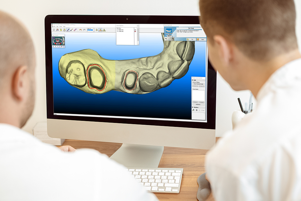 Analyse des Scans in Abstimmung zwischen Zahnarzt und Zahntechniker