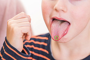 Sprachbildung bei Kindern: Zähne, Zunge und Mundmuskulatur sind wichtig!
