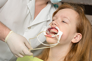 Unsachgemäße KFO-Behandlung verschlimmert Zahnfehlstellungen