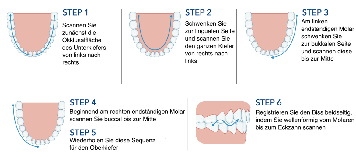 Der vorgegebene Scanpfad sollte mit Blick auf ein präzises Ergebnis unbedingt eingehalten werden.