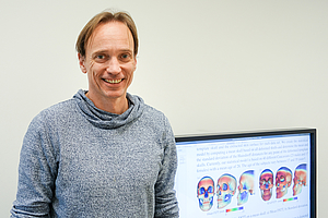 Neues Modell: Schädelform in 3D berechnen – Reduktion von Röntgenaufnahmen möglich