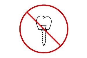 Neues Implantatregister wird keine Zahnimplantate führen