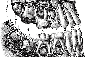 Meilensteine der Zahnmedizin und Zahntechnik
