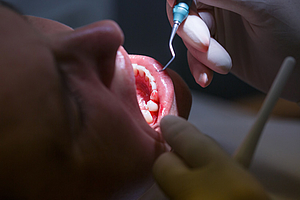 Parlamentarischer Abend der DG PARO: „Parodontitistherapie personalisiert“