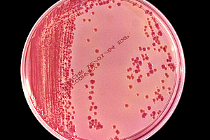 Bakterien mit extrem hoher Antibiotikaresistenz verbreiten sich über Krankenhäuser