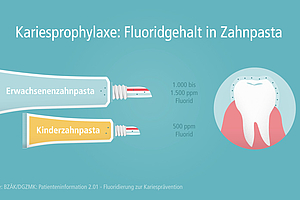 Patienteninfo: Ja zu Fluorid in der Zahnpasta