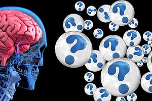 Chronische Parodontitis erhöht das Alzheimer-Risiko um 70 Prozent