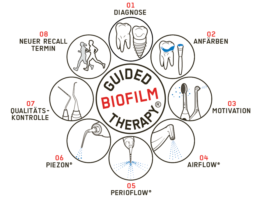 Guided Biofilm Therapy - Wie das Praxisteam moderne Prävention und Prophylaxe bieten kann 