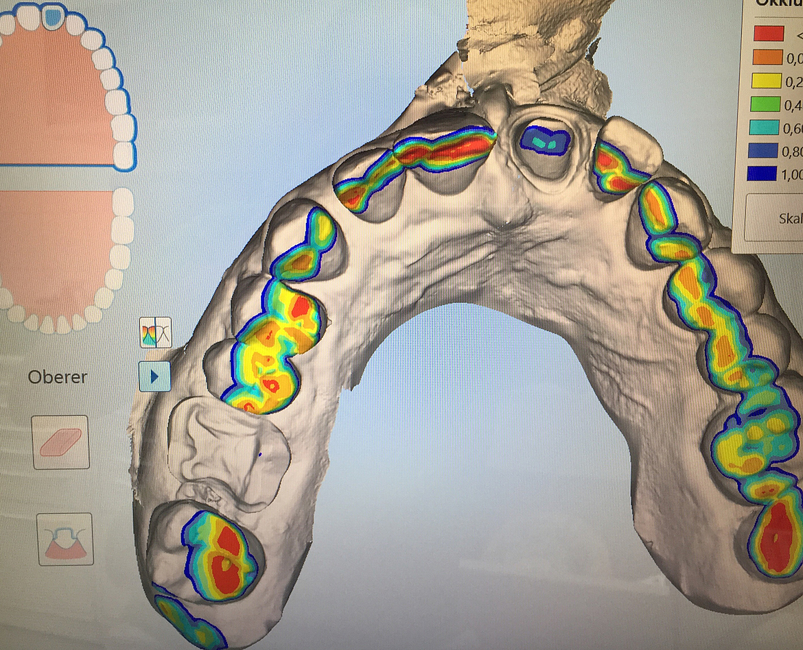 Anzeige des Höhenprofils nach Scan