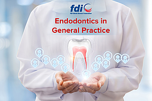 FDI: Endodontie-Whitepaper fordert Rücksicht auf Patientengesundheit und -wohlbefinden bei der Therapie