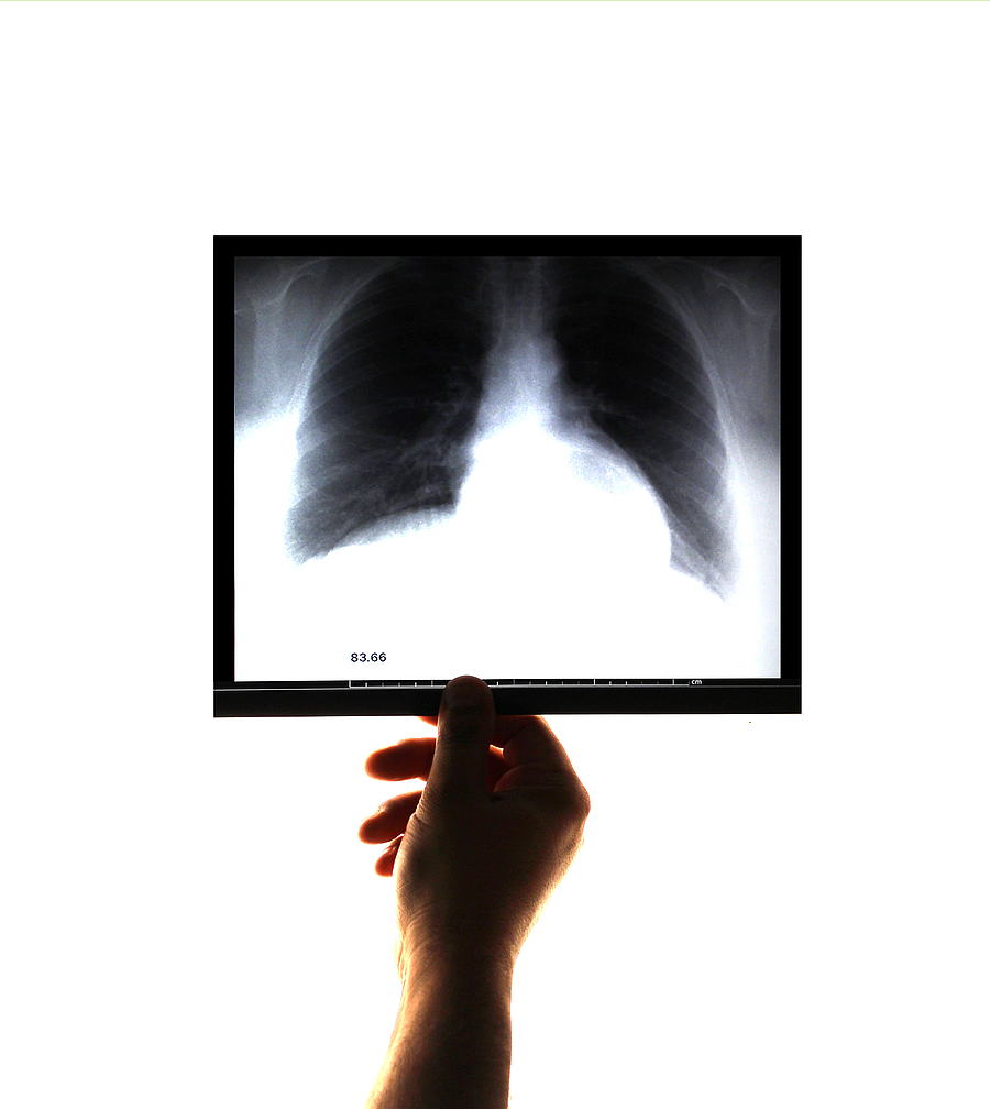 Notfälle in der Zahnarztpraxis: Respiratorische Notfälle – exazerbierte COPD