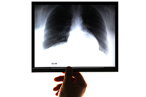 Notfälle in der Zahnarztpraxis: Respiratorische Notfälle – exazerbierte COPD