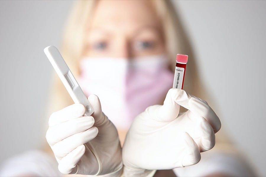 Selbsttest zur Optimierung der oralen Immunabwehr