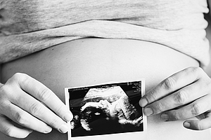 Handfehlbildungen bei Neugeborenen: Zusammenhang mit Amalgamfüllungen der Mutter?
