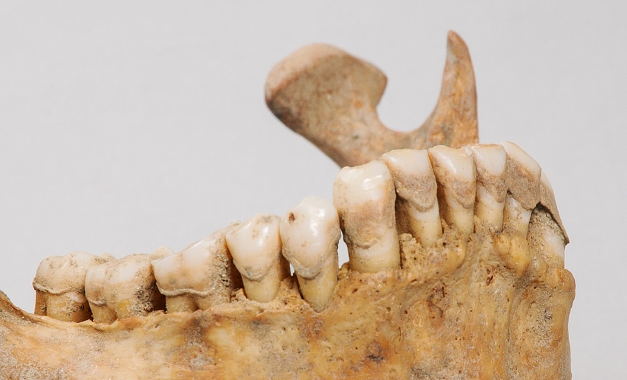 Mumienforschung: Alter Zahnstein – neue Einblicke in die Evolution der Mundflora
