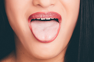 Mikrobiom der Zunge – Indikator für Bauchspeicheldrüsenkrebs
