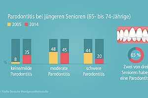 Achtung Parodontitis: Zahnfleisch regelmäßig kontrollieren lassen!
