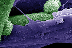 Überdosis Calcium: Nanokristalle beeinflussen die Differenzierung von Stammzellen während der Knochenbildung