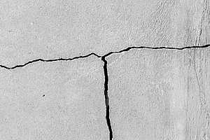 Aktualisierung der S3-Leitlinie „Fissuren- und Grübchenversiegelung“ veröffentlicht