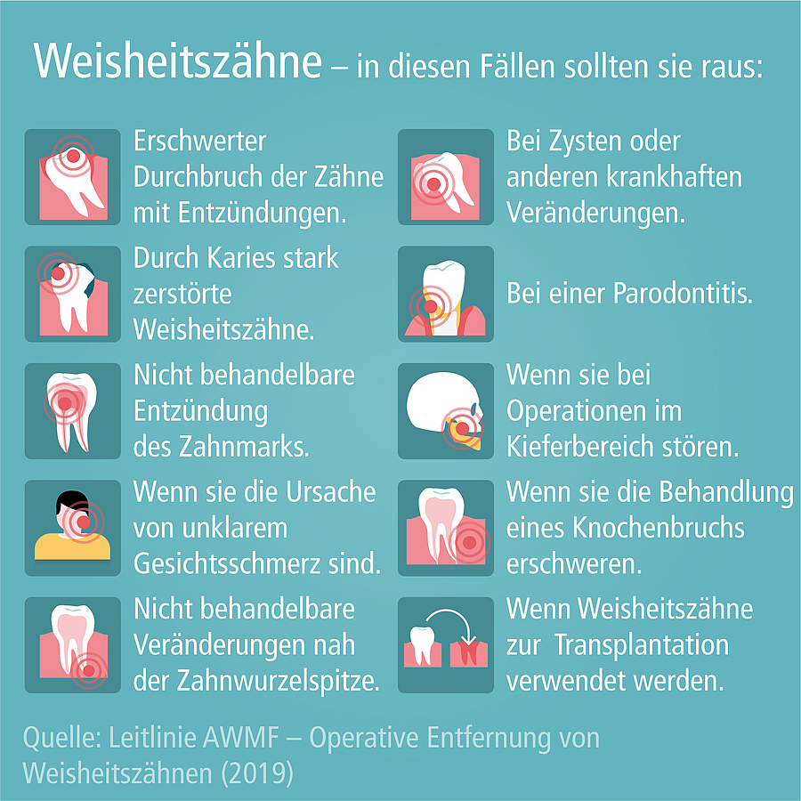 Weisheitszähne entfernen? Auf den Einzelfall kommt es an