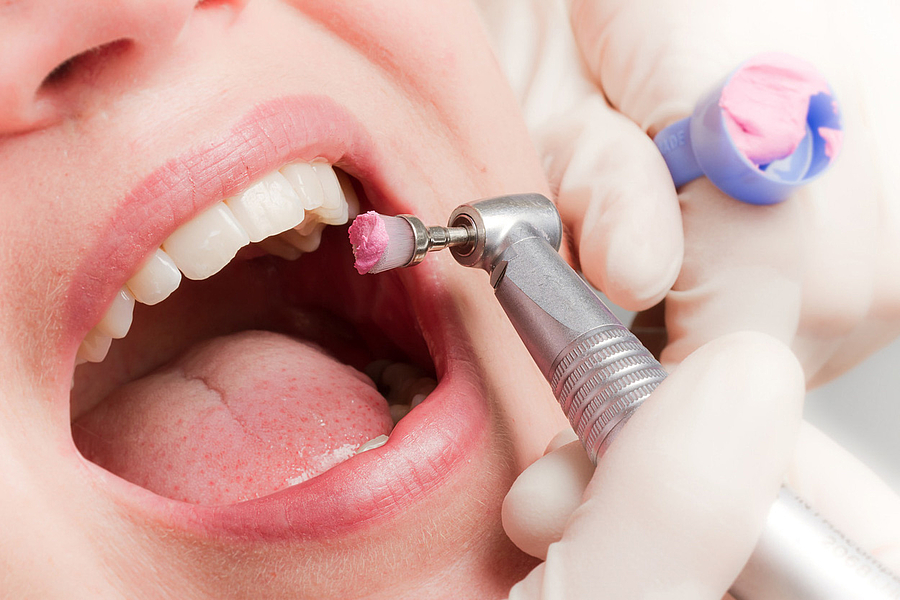 Patienteninfo PZR: Professionelle Zahnreinigung beugt vielen Krankheiten vor