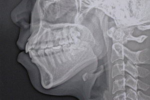 Kieferorthopädische Behandlungsplanung ohne Strahlenbelastung