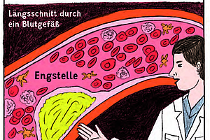 Comics bereiten Patienten besser auf eine OP vor