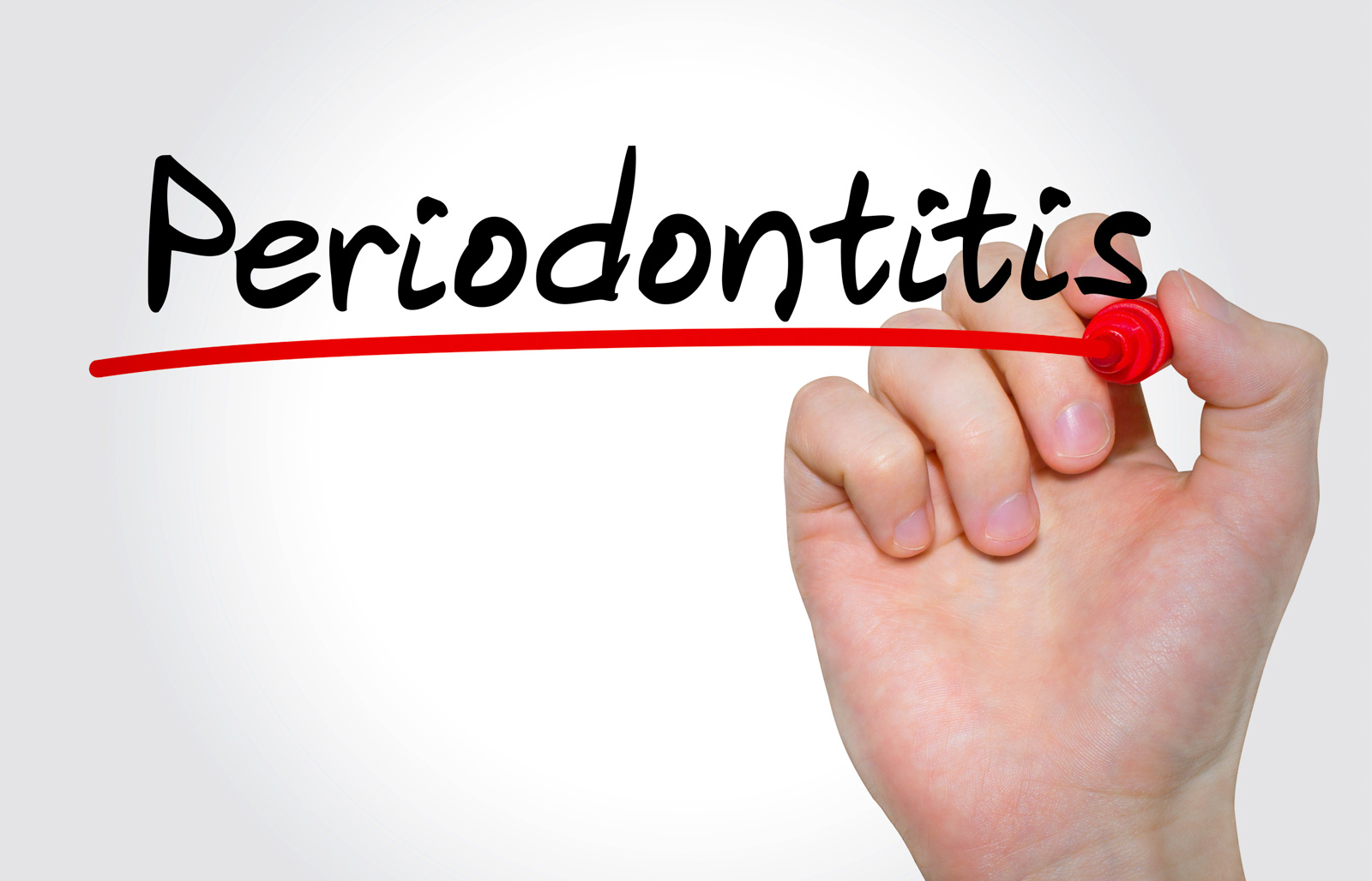 Periodontal etiological therapy: new paradigm and strategies