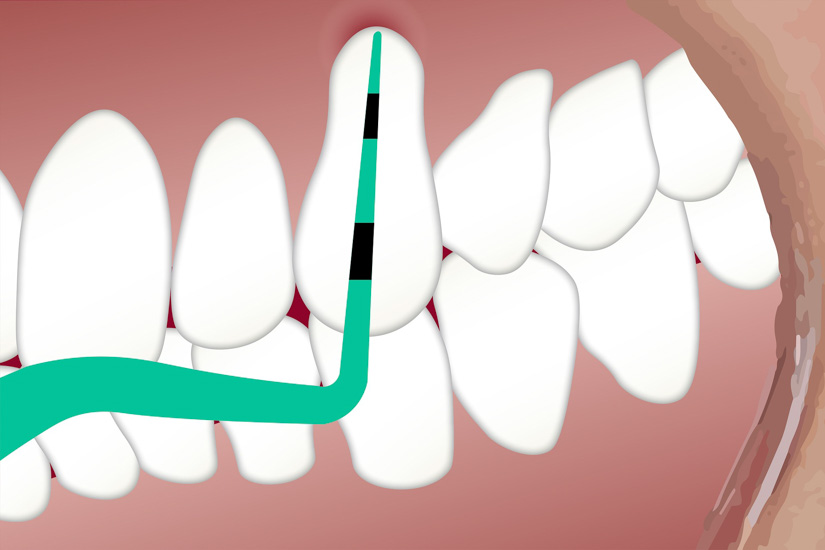 PAR-Online Fortbildungsserie - für Zahnärzt:innen