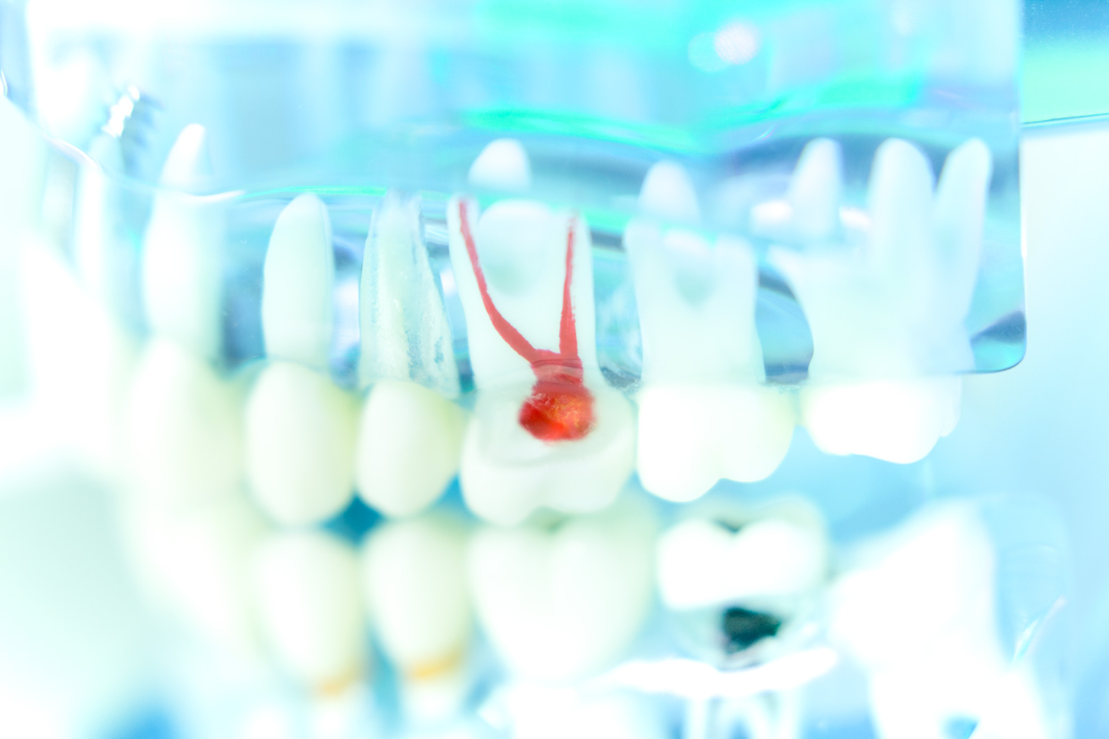 Der endodontische Notfall Der endodontische Notfall