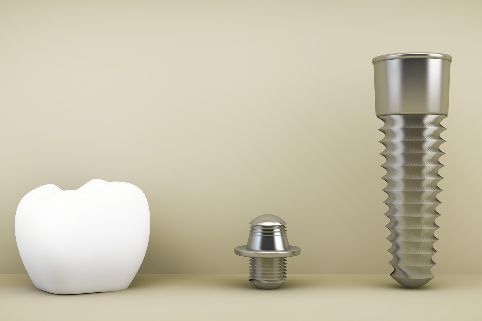 Implantatversorgung leicht gemacht Implantatversorgung leicht gemacht