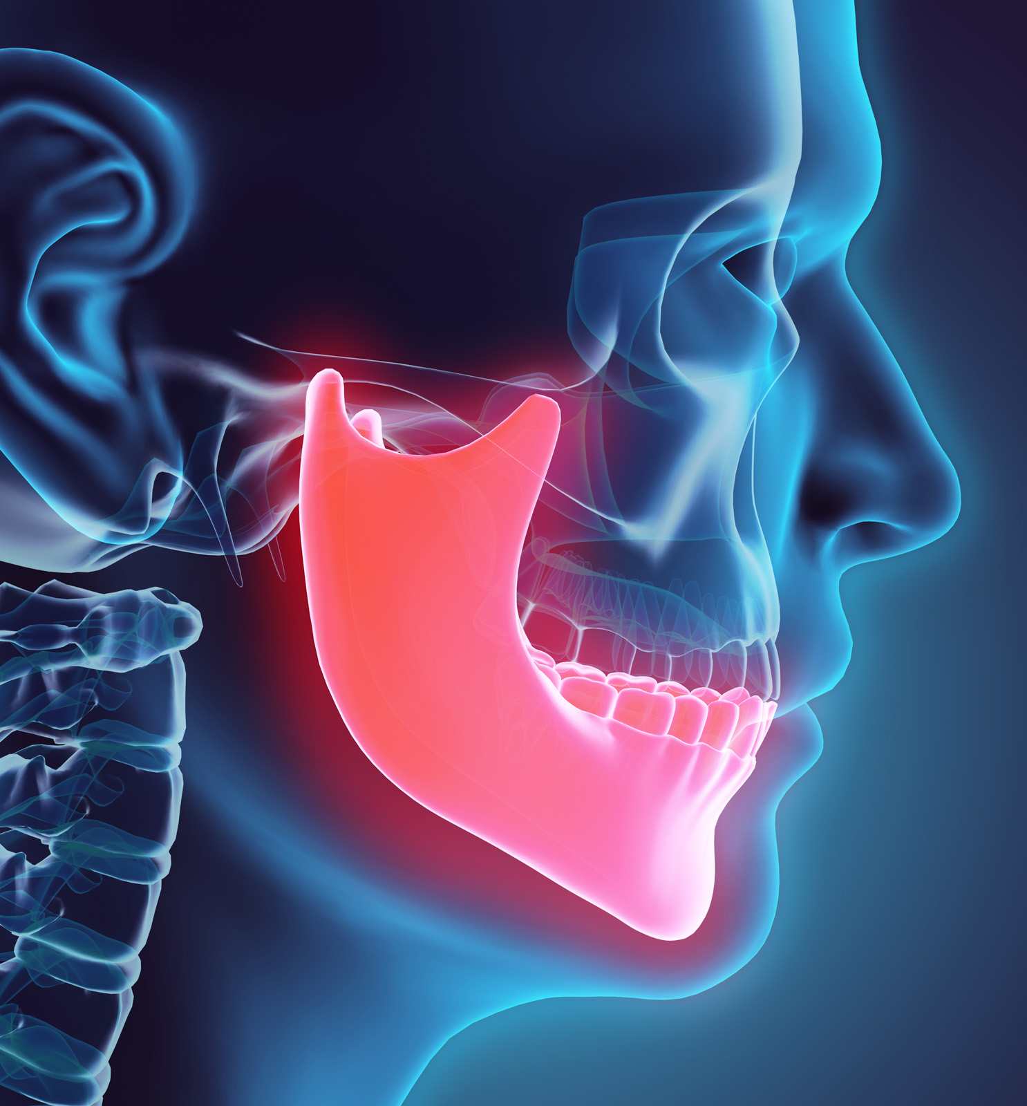 Anatomiekurs am Humanpräparat Sinuslift+Osteoplastik