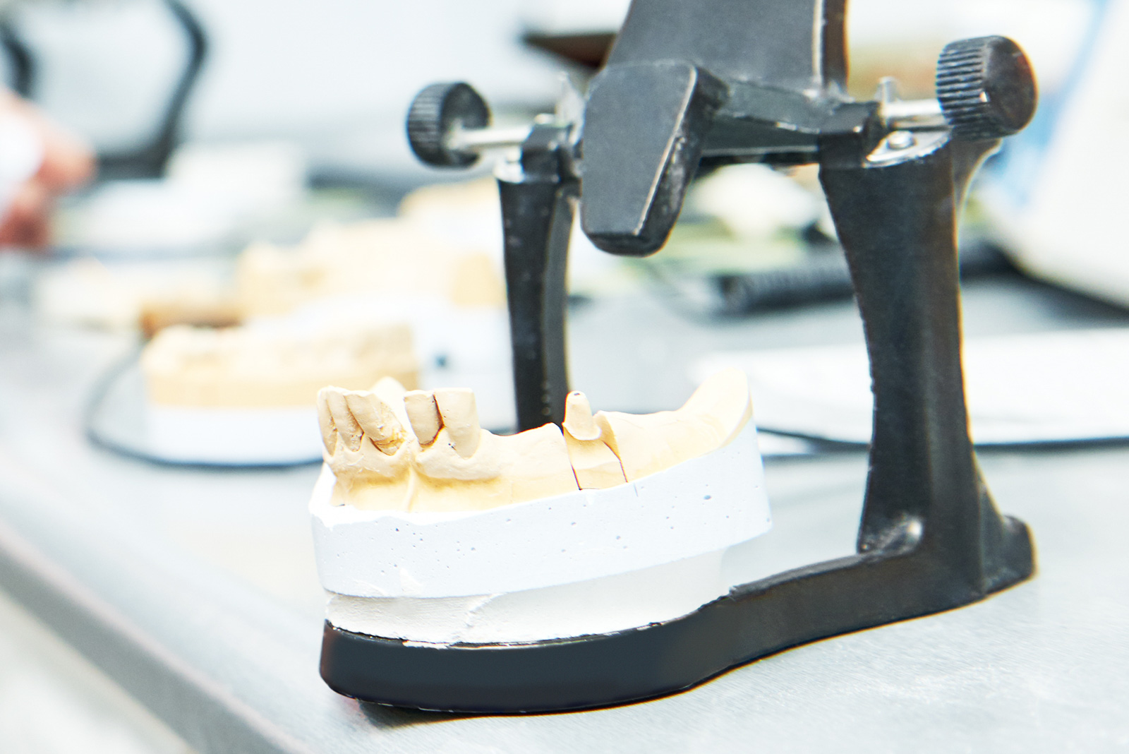 Eigenlabor und unentdeckte Chairsideleistungen - Dental Masterclub Zahnarztpraxis für Spezialisten Eigenlabor und unentdeckte Chairsideleistungen - Dental Masterclub Zahnarztpraxis für Spezialisten
