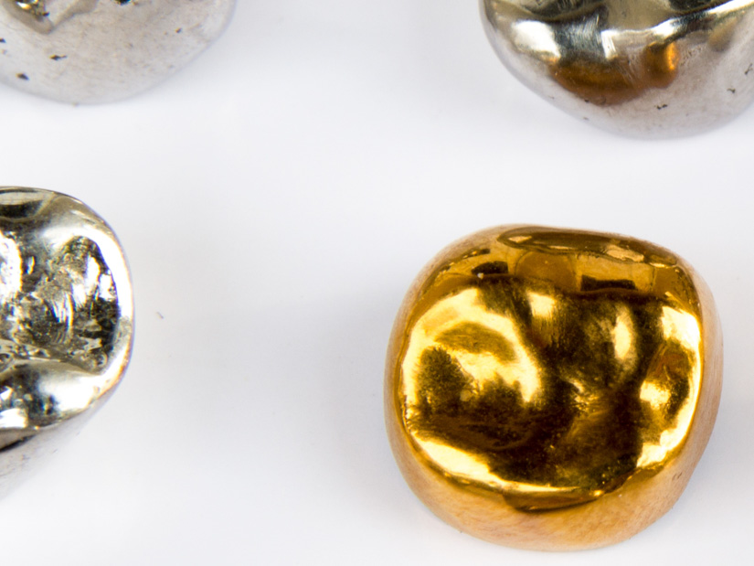 10.000 Euro dank Altgold-Spenden