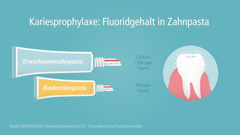 Patienteninfo: Ja zu Fluorid in der Zahnpasta
