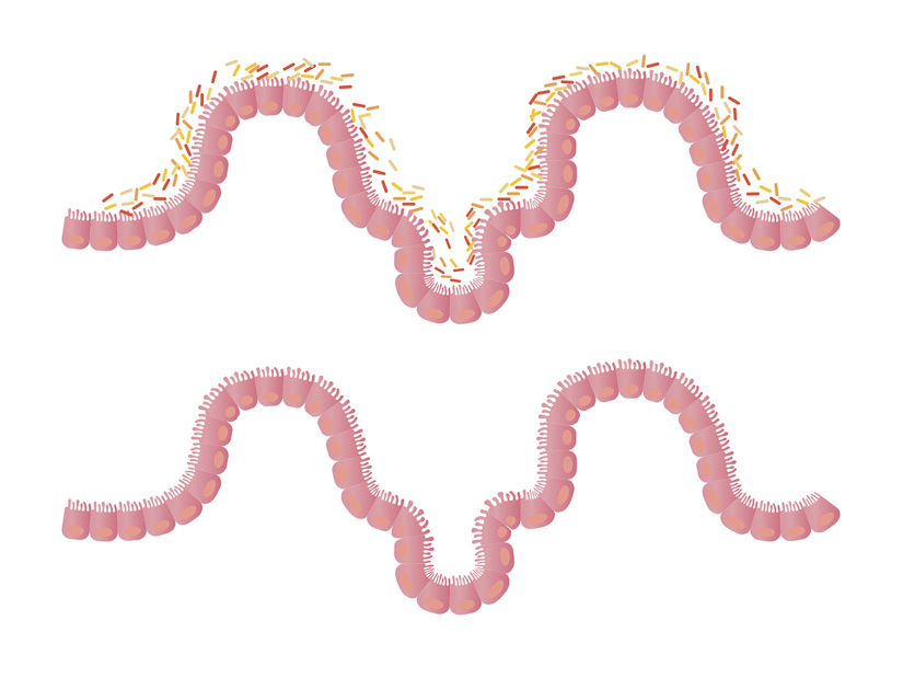 Repetitorium Mikrobiom: Individuelles bakterielles Getümmel