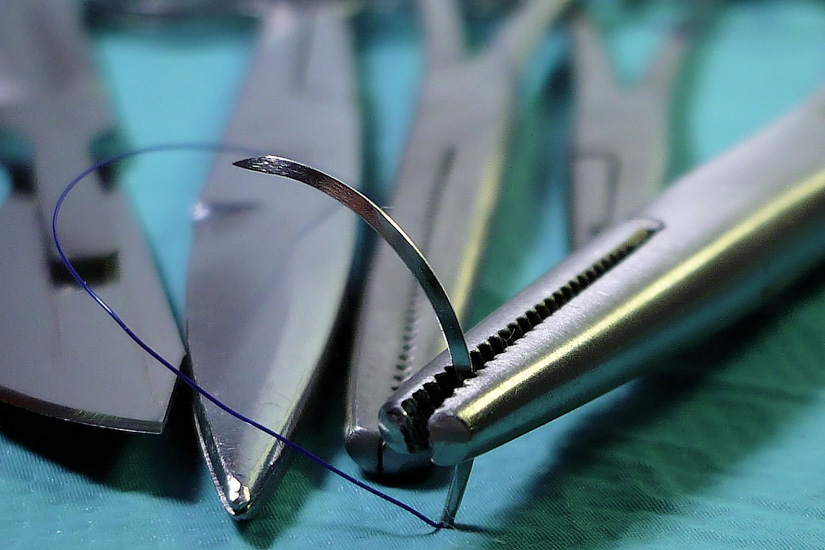Wundverschluss und Wundheilung: Nahttechnik in Parodontal- und Implantatchirurgie 