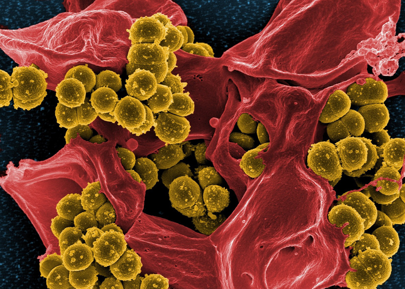 Antibiotika am Limit? Bakterien wappnen sich gegen Reservemittel