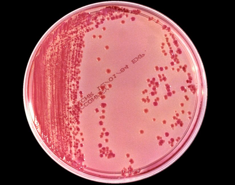 Bakterien mit extrem hoher Antibiotikaresistenz verbreiten sich über Krankenhäuser