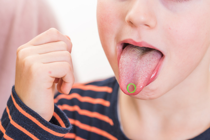 Sprachbildung bei Kindern: Zähne, Zunge und Mundmuskulatur sind wichtig!