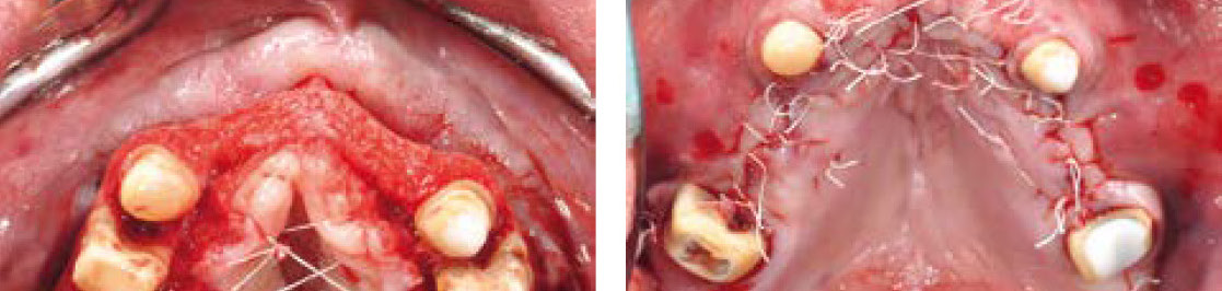 Simplify your Augmentation: Prinzipien – Konzepte – Techniken Simplify your Augmentation: Prinzipien – Konzepte – Techniken