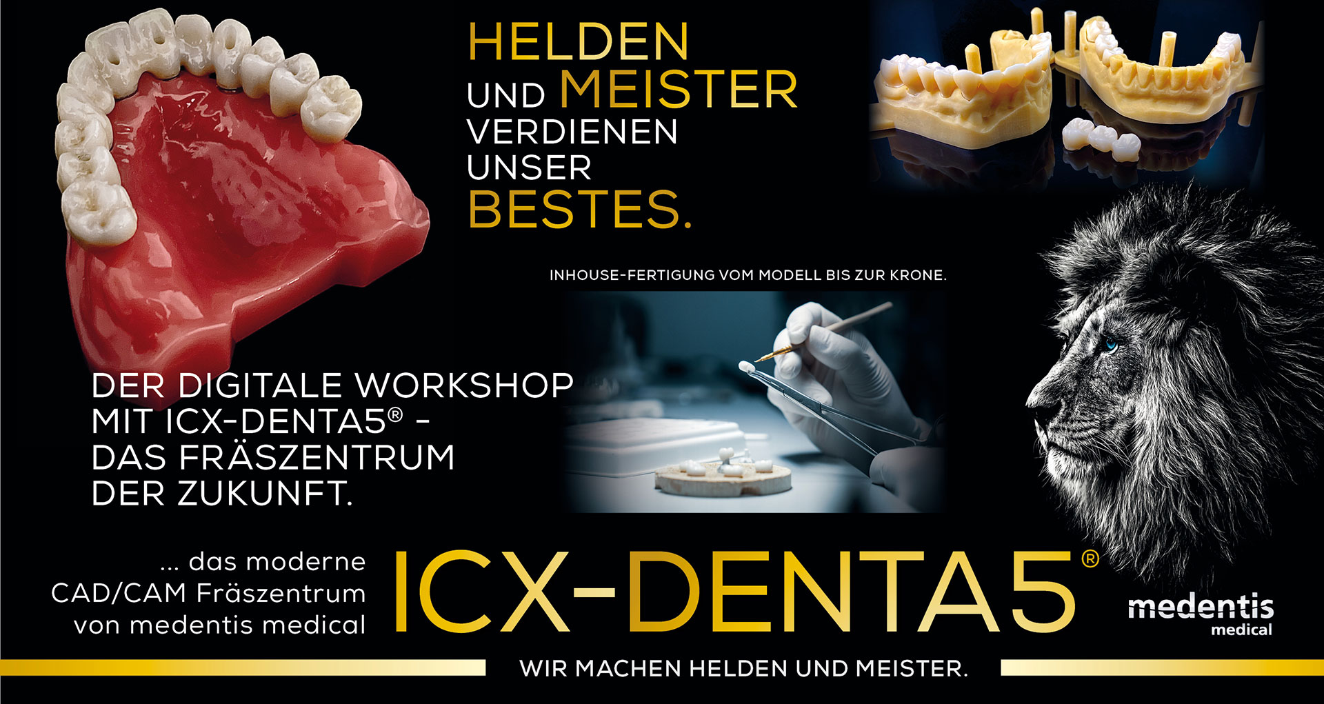Der digitale Workshop mit ICX-DENTA5® – das Fräszentrum der Zukunft Der digitale Workshop mit ICX-DENTA5® – das Fräszentrum der Zukunft