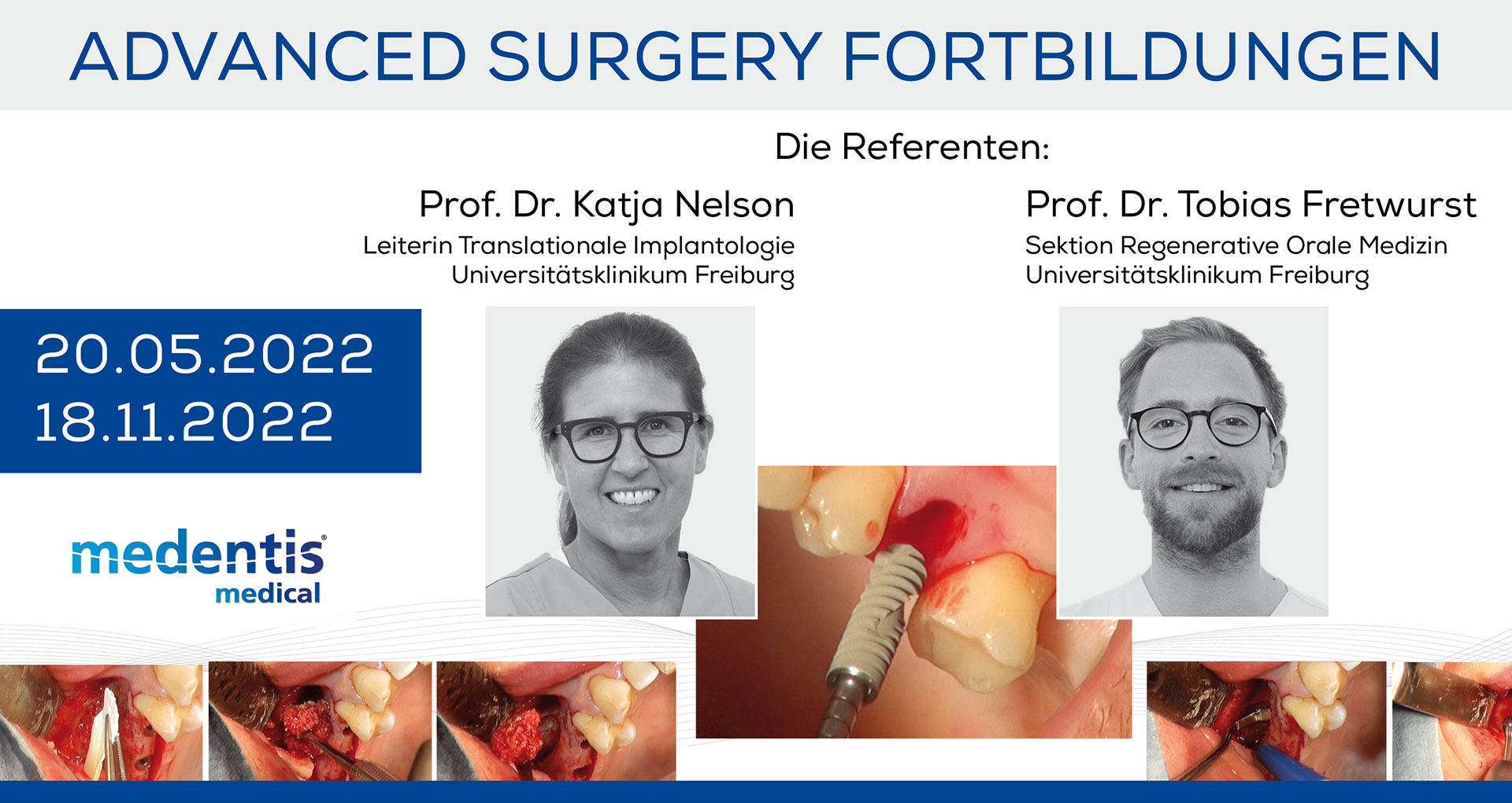 Advanced Surgery Fortbildungen Advanced Surgery Fortbildungen