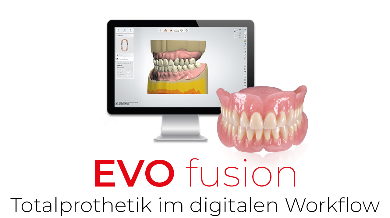 EVO fusion – Totalprothetik im digitalen Workflow