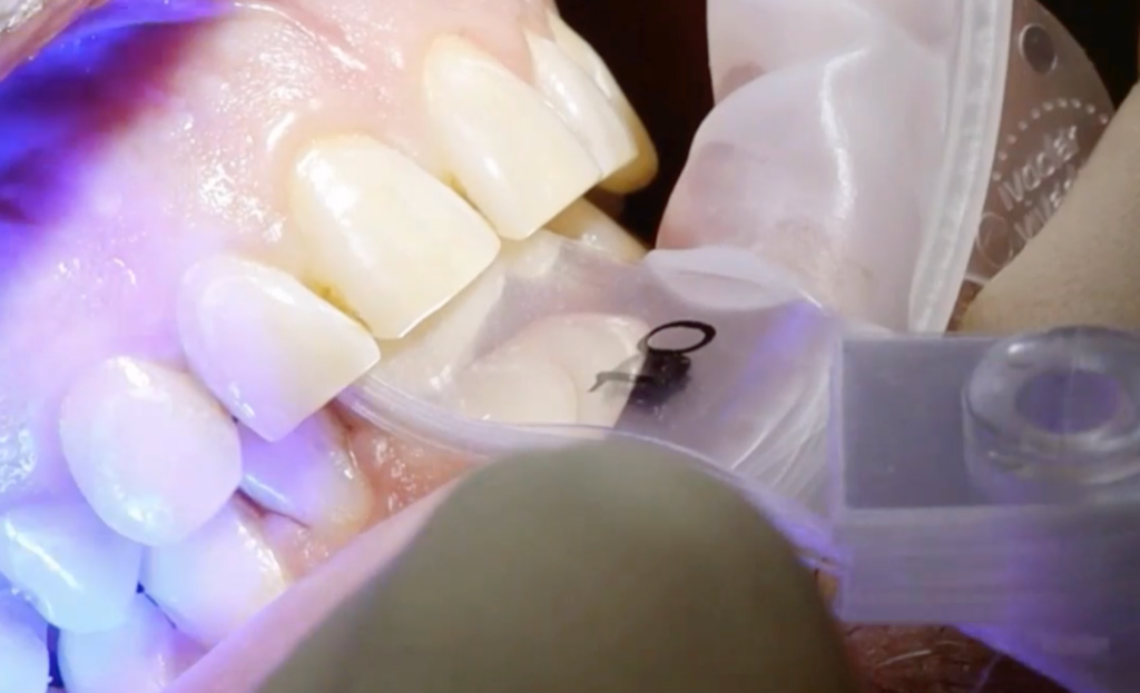CEREC® Function CEREC® Function