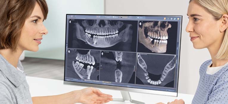 Sidexis 4 Online-Training - Aufbaukurs 3D-Röntgen