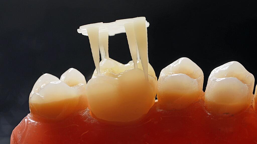 3D Druck in der CEREC®-Praxis 3D Druck in der CEREC®-Praxis
