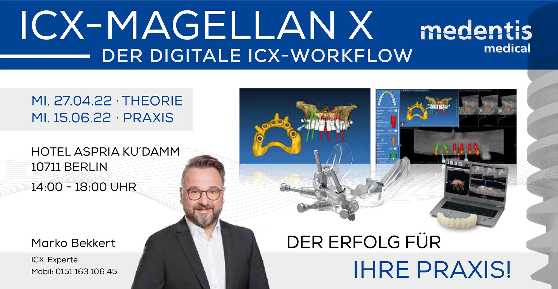 ICX-DENTA5® und der digitale ICX-Workflow - Theorie ICX-DENTA5® und der digitale ICX-Workflow - Theorie